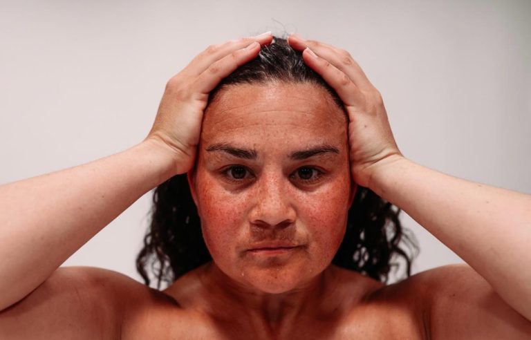 KvinnehelseIBevegelse_Foto_KristofferSkogheim Nina Wollny har hendenen på hodet.